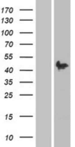 Novus Biologicals™ Pax2 Overexpression Lysate