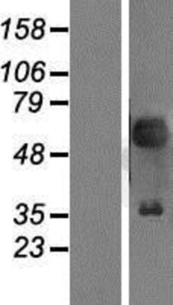 Novus Biologicals&trade;&nbsp;Pax2 Overexpression Lysate