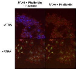 Pax6 Antibody, Novus Biologicals 0.1mg; Unlabeled:Antibodies, Polyclonal