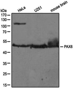 Pax6 Antibody, Novus Biologicals 0.1mg; Unlabeled:Antibodies, Polyclonal