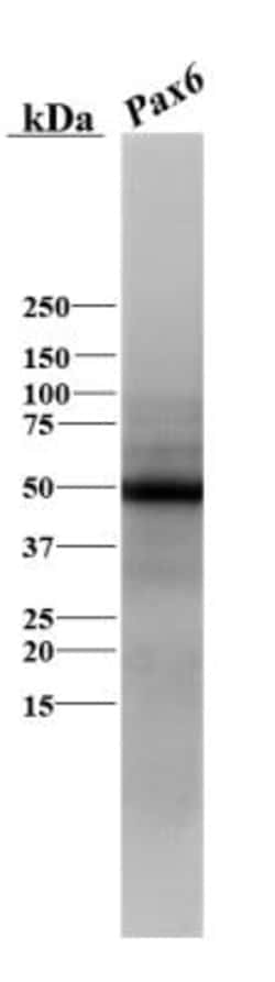 Pax6 Antibody, Novus Biologicals 0.1mg; Unlabeled:Antibodies, Polyclonal