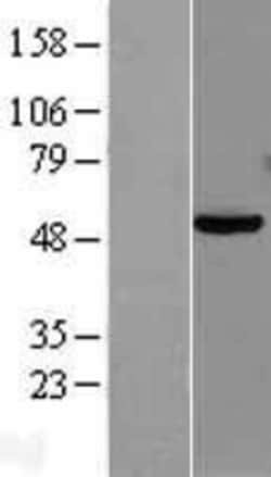 Novus Biologicals™ PAX8 Overexpression Lysate