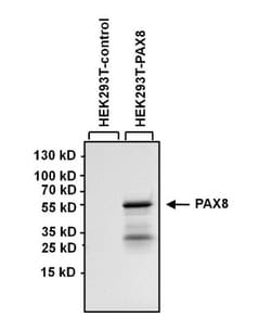 PAX8 Antibody (1F8-3A8), Novus Biologicals 100 &mu;g | Buy Online | Novus Biologicals | Fisher Scientific