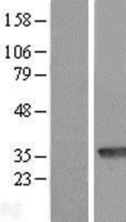 Novus Biologicals&trade;&nbsp;PBLD Overexpression Lysate