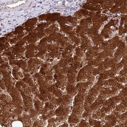 PBLD Antibody, Novus Biologicals:Antibodies:Primary Antibodies