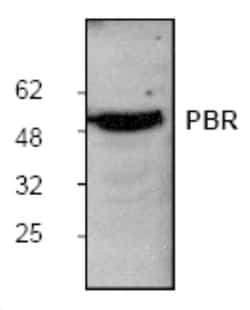 PBR Antibody, Novus Biologicals 0.1 mg; Unconjugated:Antibodies, Polyclonal