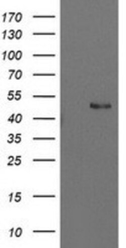 PBX1 Antibody (OTI1C11), Novus Biologicals 0.1mL; Unlabeled:Antibodies,