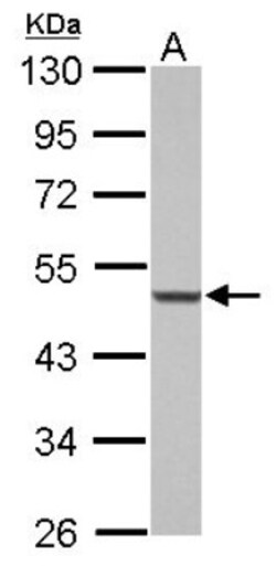 PBX1 Antibody, Novus Biologicals 0.1mL; Unlabeled:Antibodies, Polyclonal