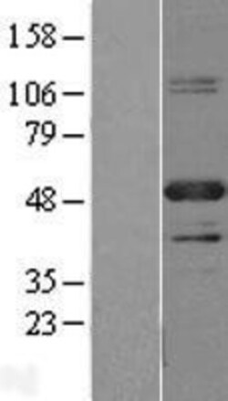 Novus Biologicals™ PBX1 Overexpression Lysate