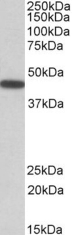 PBX1 Antibody, Novus Biologicals 0.1mg; Unlabeled:Antibodies, Polyclonal