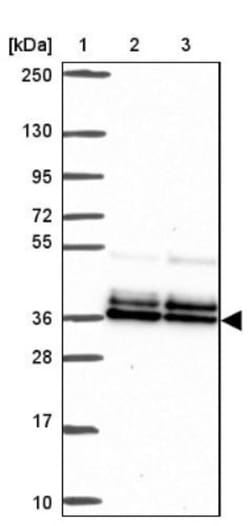 PBX2 Antibody, Novus Biologicals 0.1mL; Unlabeled:Antibodies, Polyclonal