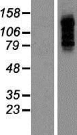 Novus Biologicals&trade;&nbsp;PBXIP1 Overexpression Lysate