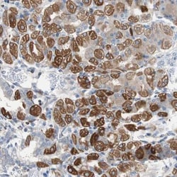 PBXIP1 Antibody, Novus Biologicals 25 &mu;L; Unlabeled:Antibodies, Polyclonal