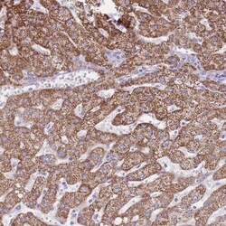 Proprotein Convertase 1/PCSK1 Antibody, Novus Biologicals:Antibodies:Primary
