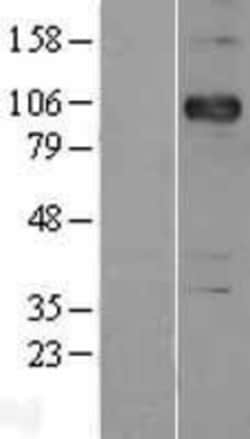 Novus Biologicals&trade;&nbsp;P-Cadherin Overexpression Lysate