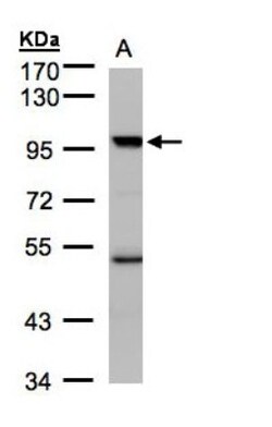 PCAF Antibody, Novus Biologicals 0.1mL; Unlabeled:Antibodies, Polyclonal