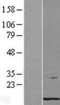 Novus Biologicals&trade;&nbsp;PCBD1 Overexpression Lysate