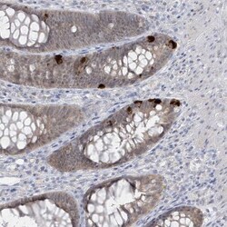 PCBD1 Antibody, Novus Biologicals 0.1mL; Unlabeled:Antibodies, Polyclonal