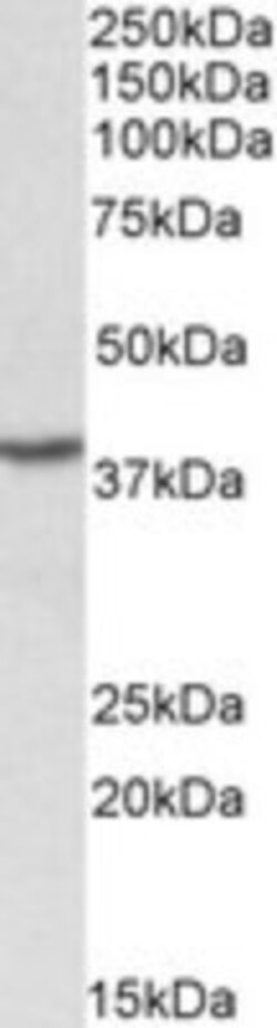PCBP1 Antibody, Novus Biologicals 0.1mg; Unlabeled:Antibodies, Polyclonal