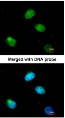 PCBP2 Antibody, Novus Biologicals 0.1mL; Unlabeled:Antibodies, Polyclonal