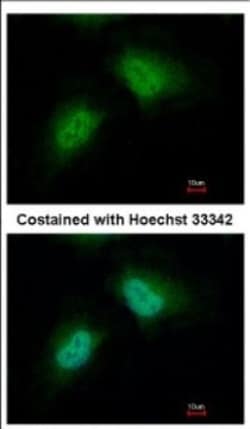 PCBP2 Antibody, Novus Biologicals 0.1mL; Unlabeled:Antibodies, Polyclonal