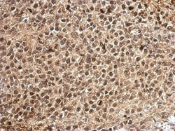 PCBP2 Antibody, Novus Biologicals 0.1mL; Unlabeled:Antibodies, Polyclonal