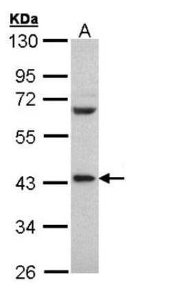 PCBP2 Antibody, Novus Biologicals 0.1mL; Unlabeled:Antibodies, Polyclonal