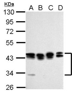 PCBP2 Antibody, Novus Biologicals 0.1mL; Unlabeled:Antibodies, Polyclonal