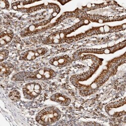 PCBP3 Antibody, Novus Biologicals:Antibodies:Primary Antibodies