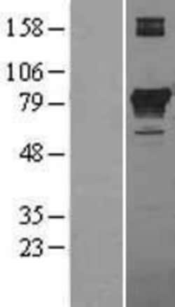 Novus Biologicals&trade;&nbsp;PCCA Overexpression Lysate