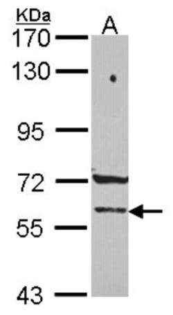 PCCB Antibody, Novus Biologicals 0.1mL; Unlabeled:Antibodies, Polyclonal
