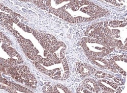 PCCB Antibody, Novus Biologicals 0.1mL; Unlabeled:Antibodies, Polyclonal