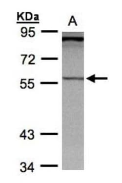 PCCB Antibody, Novus Biologicals 0.1mL; Unlabeled:Antibodies, Polyclonal