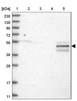 PCCB Antibody, Novus Biologicals 0.1 mL | Buy Online | Novus Biologicals | Fisher Scientific