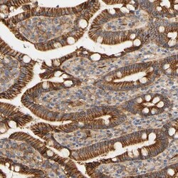 PCDH7 Antibody, Novus Biologicals 0.1mL; Unlabeled:Antibodies, Polyclonal