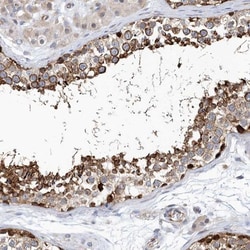 PCDHA2 Antibody, Novus Biologicals 0.1mL; Unlabeled:Antibodies, Polyclonal