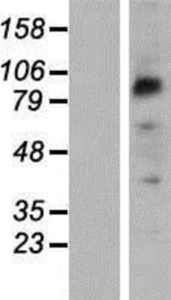 Novus Biologicals™ PCDHB2 Overexpression Lysate