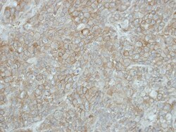 PCDHGB5 Antibody, Novus Biologicals 0.1mL; Unlabeled:Antibodies, Polyclonal