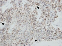 PCDHGC4 Antibody, Novus Biologicals 0.1mL; Unlabeled:Antibodies, Polyclonal