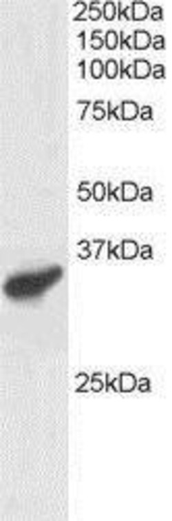 PCGF3 Antibody, Novus Biologicals 0.1mg; Unlabeled:Antibodies, Polyclonal
