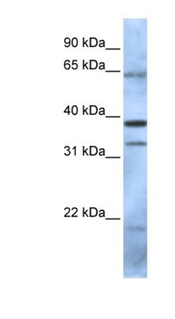 PCGF5 Antibody, Novus Biologicals 0.05mg; Unlabeled:Antibodies, Polyclonal