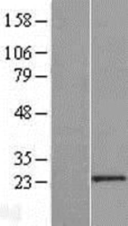 Novus Biologicals™ PCGF6 Overexpression Lysate