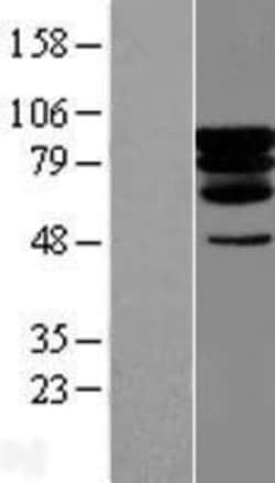 Novus Biologicals&trade;&nbsp;PCIF1 Overexpression Lysate