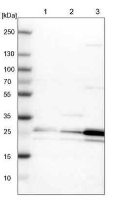 PCMT1 Antibody, Novus Biologicals 0.1mL; Unlabeled:Antibodies, Polyclonal