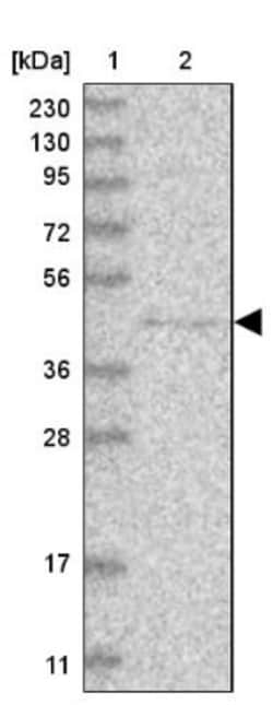 PCMTD1 Antibody, Novus Biologicals 25 &mu;L; Unlabeled:Antibodies, Polyclonal