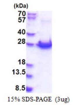 Novus Biologicals&trade;&nbsp;Recombinant Human PCMTD1 His Protein