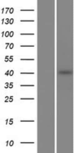 Novus Biologicals™ PCMTD2 Overexpression Lysate