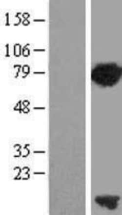 Novus Biologicals&trade;&nbsp;PCNA associated factor Overexpression Lysate