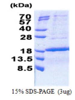 Novus Biologicals Recombinant Human PCNA associated factor His Protein 0.05 mg | Buy Online | Novus Biologicals&trade; | Fisher Scientific