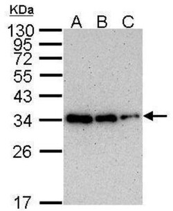 PCNA Antibody (339), Novus Biologicals 0.1mg; Unlabeled:Antibodies, Monoclonal